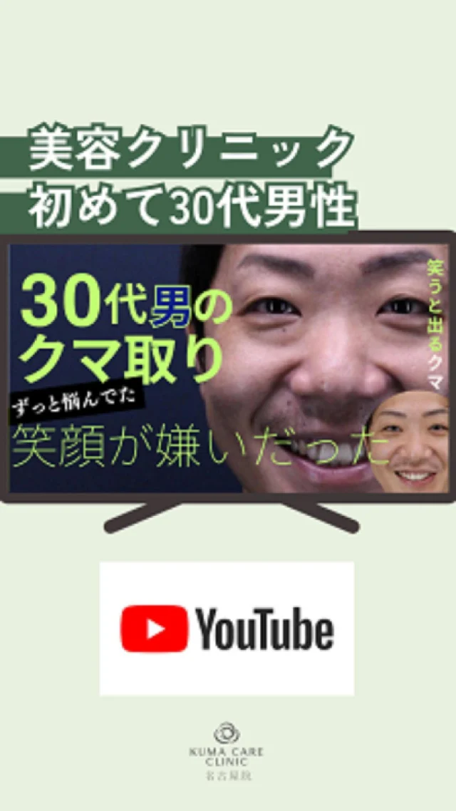 🌿
YouTube更新しました！
今回は
『笑った時のクマが嫌』

美容クリニック初めての
30代男性のクマ取り実録です！

続きはYouTubeでご覧くださいませ✨

________________________ 
 
■施術名  下眼瞼経結膜脱脂術 
■価格一律　  250,000円（税抜価格 227,273円） 
■リスク 
◉内出血・むくみ 
　出来る限り丁寧に処置していますが、 
　術後1〜2週間程度は生じる可能性があります。 
◉術後出血 
　治癒過程により、術後1週間以内は 
　血液混じりの涙が出る可能性があります。 
◉結膜浮腫・結膜出血 
　かなり稀ですが生じる可能性があります。 
　一般的には術後1～2週間で軽快します。 
 
_________________________ 
 
KUMA CARE CLINIC 名古屋院 
📍名古屋市西区名駅3-10-15 名駅三丁目ビル2階 
☎️052-564-7070 
⏰9:00〜18:00 
_________________________ 
 
#KUMACARECLINIC名古屋 #クマケアクリニック名古屋 
#クマ治療 #クマケア #クマ取り #脱脂術 
#クマ取り脱脂術 #目の下のたるみ取り 
#目の下のクマ取り #目の下のクマたるみ取り 
#目の下の若返り #アンチエイジング 
#くま #クマ #下眼瞼脱脂術 #たるみ 
#愛知 #名古屋 #名駅 #クマ治療名古屋 
#美容外科 #美容外科名古屋 #クマ取り専門　 
#美容整形 #美容クリニック