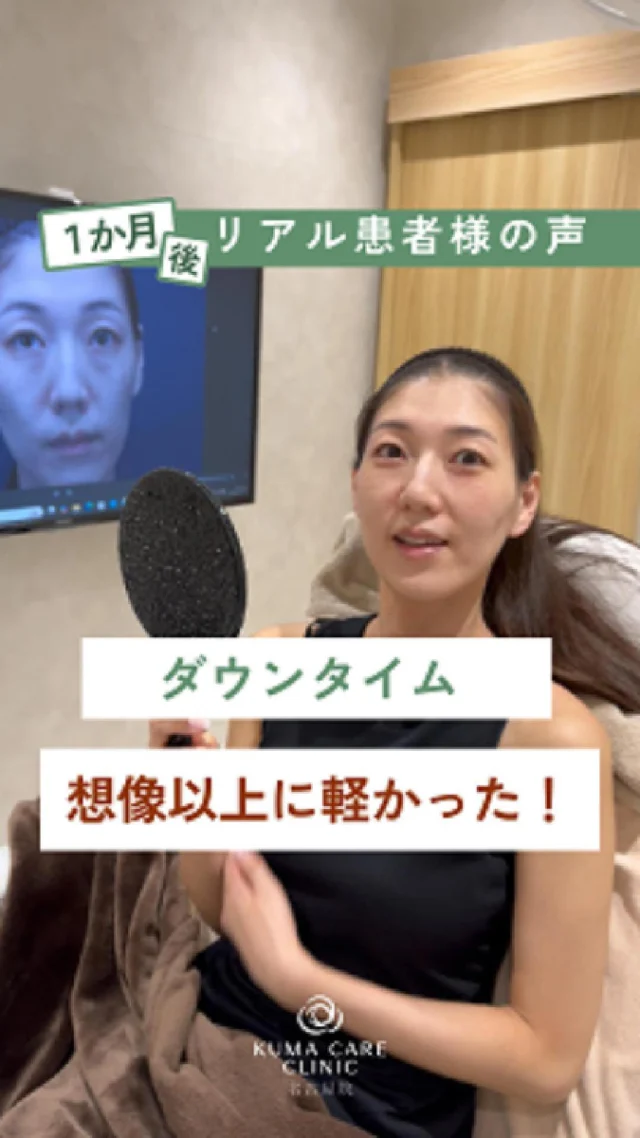 💬 
クマ取りから1か月後インタビュー
患者様のリアルな感想は…
👉 「ダウンタイムが想像よりすごく軽かった！」

✔ もっと腫れると思っていたけど、生活にほとんど支障なし
✔ 周りに気づかれず自然に過ごせた
✔ 仕上がりもナチュラルで満足度◎

目元の印象が変わると、疲れ顔から一気に明るい表情に✨
“ダウンタイムが不安…”という方に、ぜひ見てほしいリアル体験です。

_________________________ 
 
■施術名  下眼瞼経結膜脱脂術 
■価格　  250,000円（税抜価格 227,273円） 
■リスク 
◉内出血・むくみ 
　出来る限り丁寧に処置していますが、 
　術後1〜2週間程度は生じる可能性があります。 
◉術後出血 
　治癒過程により、術後1週間以内は 
　血液混じりの涙が出る可能性があります。 
◉結膜浮腫・結膜出血 
　かなり稀ですが生じる可能性があります。 
　一般的には術後1～2週間で軽快します。 
 
_________________________ 
 
KUMA CARE CLINIC 名古屋院 
📍名古屋市西区名駅3-10-15 名駅三丁目ビル2階 
☎️052-564-7070 
⏰9:00〜18:00 
_________________________