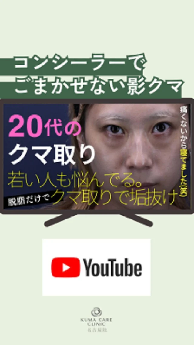 🍃
20代といっても「クマ」は他人事ではありません。
学生時代からコンシーラーが手放せない方、疲れて見られるのが嫌で厚塗りしてしまう方も多いです🥺

今回の動画は、20代でクマに悩んでいた方の実録ストーリー。
👉 クマ取りで目元の影が改善され、メイクで自然にカバーできるようになりました。
👉 厚塗りしなくても垢抜けて見える！

「若いのにクマで悩んでる…」という方にぜひ見ていただきたい内容です✨
_________________________ 
 
■施術名  下眼瞼経結膜脱脂術 
■価格　  250,000円（税抜価格 227,273円） 
■リスク 
◉内出血・むくみ 
　出来る限り丁寧に処置していますが、 
　術後1〜2週間程度は生じる可能性があります。 
◉術後出血 
　治癒過程により、術後1週間以内は 
　血液混じりの涙が出る可能性があります。 
◉結膜浮腫・結膜出血 
　かなり稀ですが生じる可能性があります。 
　一般的には術後1～2週間で軽快します。 
 
_________________________ 
 
KUMA CARE CLINIC 名古屋院 
📍名古屋市西区名駅3-10-15 名駅三丁目ビル2階 
☎️052-564-7070 
⏰9:00〜18:00 
_________________________ 

 
#KUMACARECLINIC名古屋 #クマケアクリニック名古屋 
#クマ治療 #クマケア #クマ取り #脱脂術 
#クマ取り脱脂術 #目の下のたるみ取り 
#目の下のクマ取り #目の下のクマたるみ取り 
#目の下の若返り #アンチエイジング 
#くま #クマ #下眼瞼脱脂術 #たるみ 
#愛知 #名古屋 #名駅 #クマ治療名古屋 
#美容外科 #美容外科名古屋 #クマ取り専門　 
#美容整形 #美容クリニック